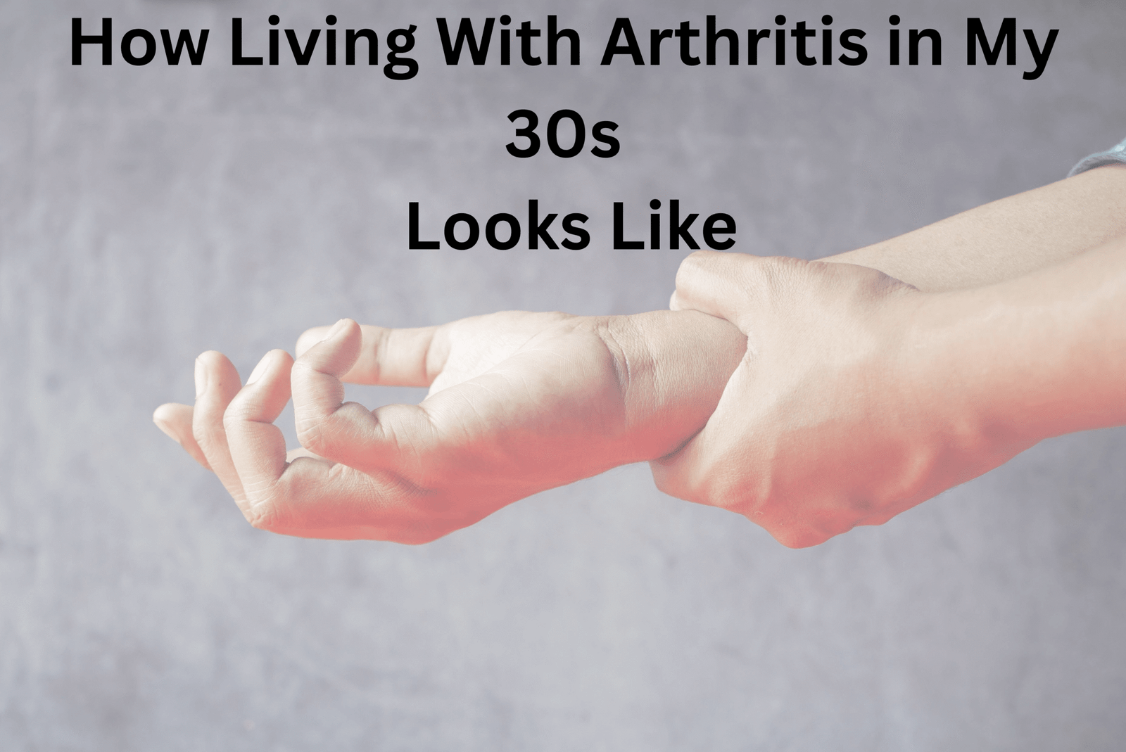 Living With Arthritis in My 30s