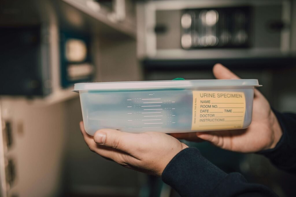 urine color chart kidney problem signs